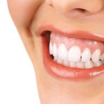 Nên trồng răng bằng cầu răng hay cấy ghép implant