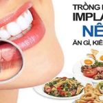 Chi phí thực hiện phẫu thuật cười hở sẽ tốn bao nhiêu tiền? Làm ở đâu thì tốt nhất?