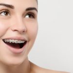Top 2 cách trị hôi miệng bằng gừng đơn giản nhanh chóng