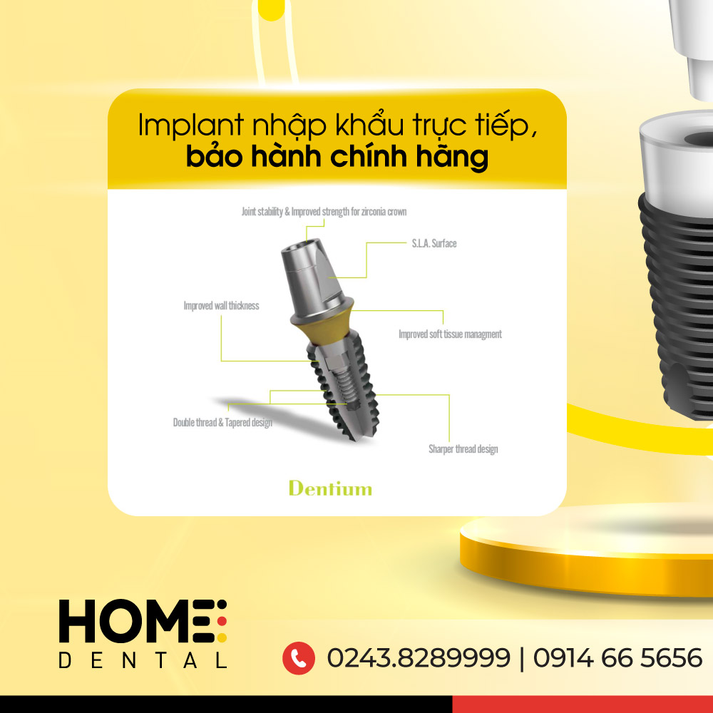 Đặc quyền khi trồng răng implant 3