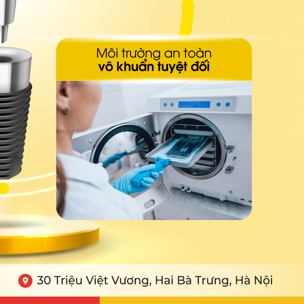 Đặc quyền khi trồng răng implant 4