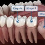 Răng bị ê buốt: Nguyên nhân và cách khắc phục