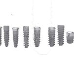 Top 5 nguyên nhân trụ implant bị đào thải