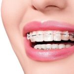 Cách phân biệt răng cấm và răng khôn